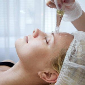 Nano-Needling Infusion With HF & Photon Treatment